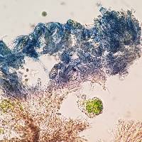 Placynthiella dasaea image