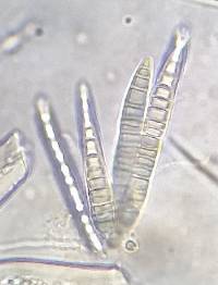 Bactrospora lamprospora image